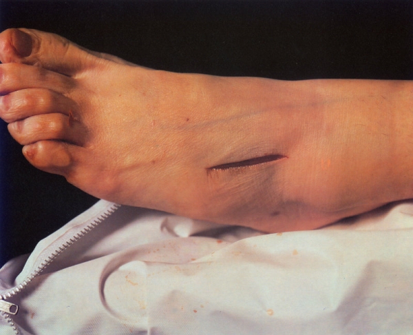Fig. 1. Andres Serrano The Morgue (Rat Poison Suicide II), 1992, cibachrome, 125,7 x 152,4 cm.