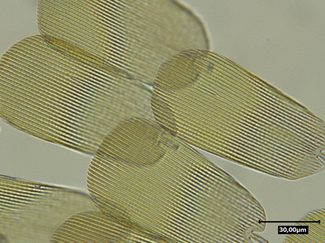 Image en transmission