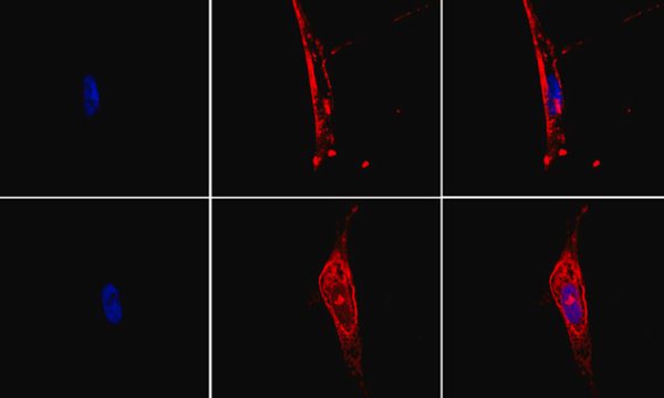 Article HCMV RESINFIT