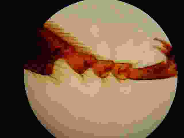 Enlarge insecte_au_microscope.jpg