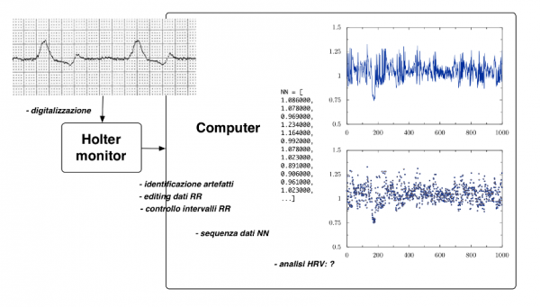 Figura 3. Digitalizzazzione del segnale elettrico cardiaco e calcolo della serie NN.