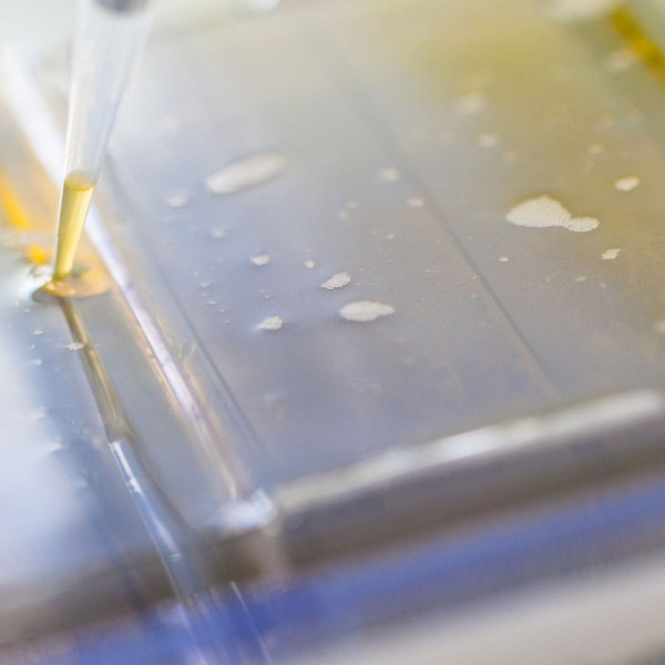 L’équipe du professeur Feuillard obtient le label Ligue nationale contre le cancer / CRIBL: a world first for Berger's disease / CRIBL: primicia mundial sobre la enfermedad de Berger